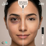 Conceal to Correct (Lifting)