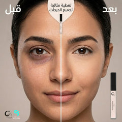 Conceal to Correct (Lifting)